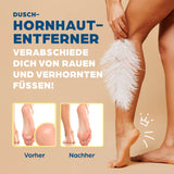 HornyFeet Hornhautentferner für die Dusche mit extragroßer Feile für sanfte, hygienische und langlebige Fußpflege – Vorher-Nachher Effekt sichtbar.